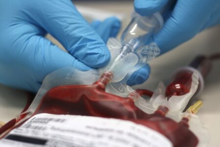 A person wearing blue gloves inserts a syringe into a blood bag filled with red blood, with a label visible on the bag.
